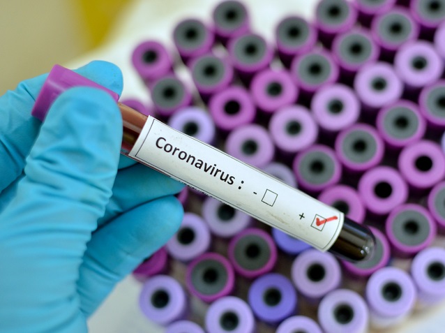 ویروس کرونا چگونه تشخیص داده می‌شود